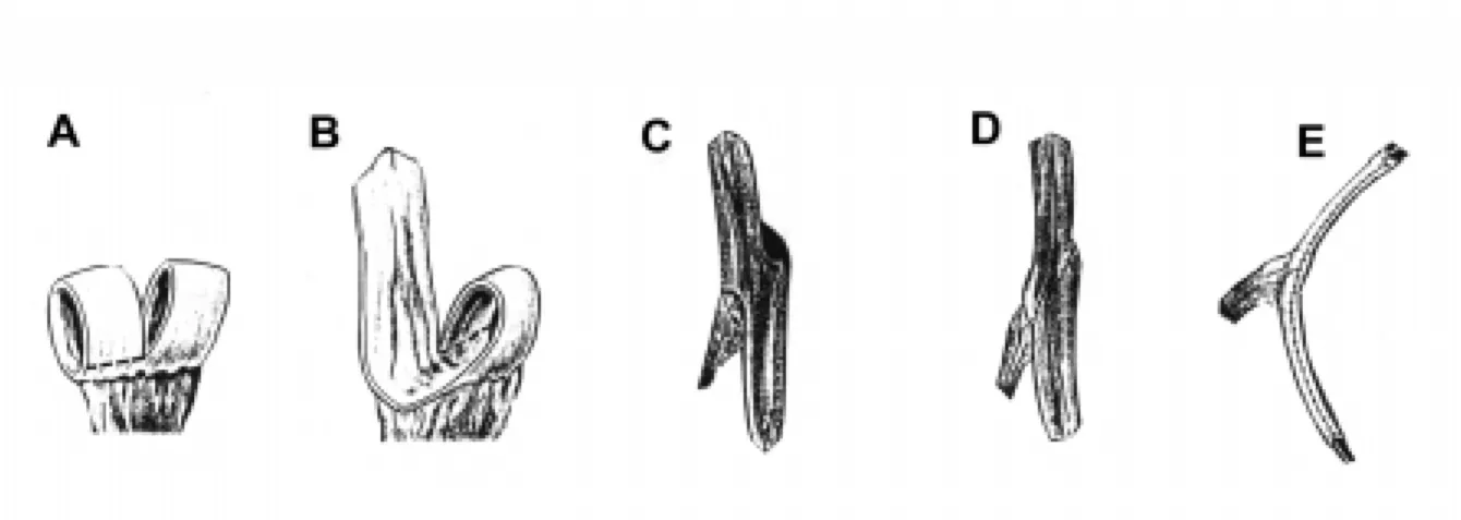 Figure 8 - Spiral Monti. A) and B) A segment of the ileum is isolated just as in the classic Monti