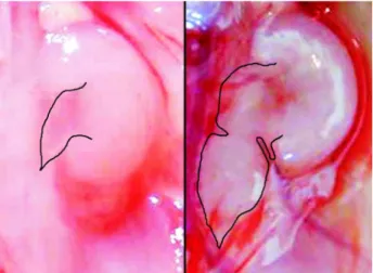 Figure 2 – Macroscopic comparison between a normal kidney from the control group (left) with hydronephrotic kidney from the adriamycin group (right)
