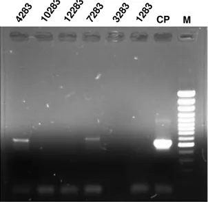 Fig.  2.1.  Ilustração  dos  resultados  obtidos  em  reacções  de  PCR  com  os  primers universais para fungos ITS1 e ITS4, usando como DNA molde as  soluções extraídas com o método TL modificado