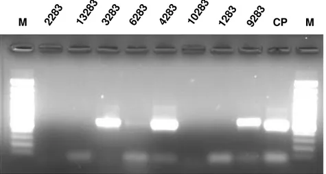 Fig.  2.2.  Ilustração  dos  resultados  obtidos  em  reacções  de  PCR  com  os  primers  universais  para  fungos  ITS1  e  ITS4,  usando  como  DNA  molde  as  soluções  extraídas com o método TE fenol