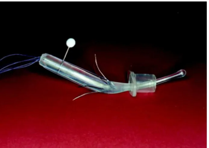 Figure 2 – Device showing the needles closed inside the cylin- cylin-der.