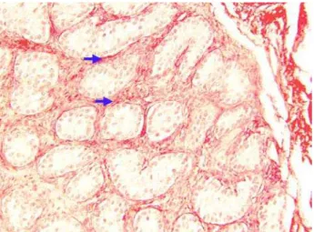 Figure 4 – Photomicrography of testicular parenchyma of a treated patient (picrosirius red, X400).