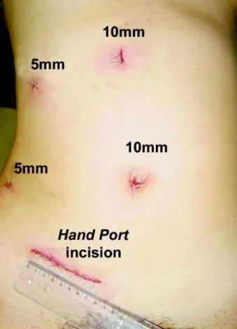 Figure 8 – Final aspect of the surgery.