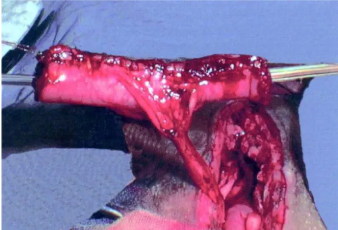 Figure 1 –  Re-tubularized jejunal segment before being inserted into the stomach.