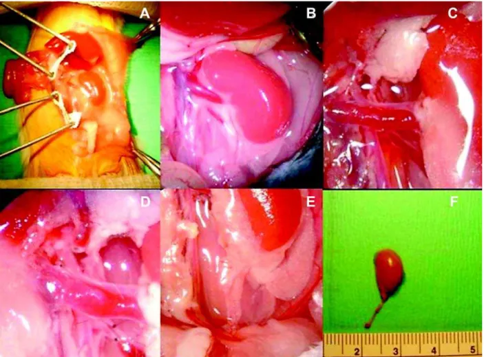 Figure 1 – Donor operation. A and B) Left kidney before dissection (B, X4). C) The renal vein and artery were dissected apart (X8)