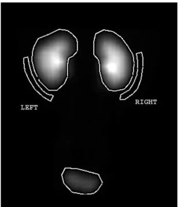 Figure 1 – Regions of interest (ROIs) drew manually in a com- com-posite image (1 to 3 minutes after the injection) of the  99m Tc-DTPA or 99m Tc-EC dynamic scintigraphies.