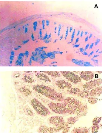 Figure 3 – Histologic section of biopsy taken from the anastomotic site showing marked reduction of acid mucins in the goblet cells (A), (AB, X40), and an increase of sialomucins and a mild reduction of sulfomucins (B), (HIDAB, X100).