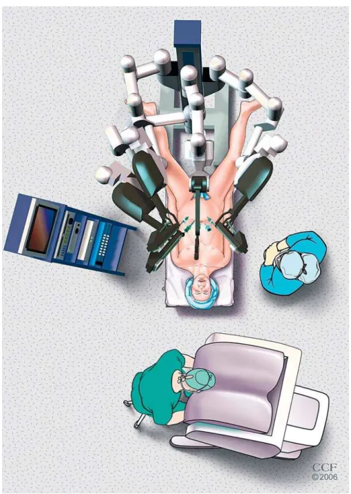 Figure 1 – Patient placed in the supine position with the legs spread to accommodate the robot