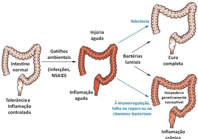 Figura 7. Possíveis respostas a uma injúria intestinal transiente em um hospedeiro geneticamente  susceptível ou geneticamente resistente (Sartor 2006 - modificado)