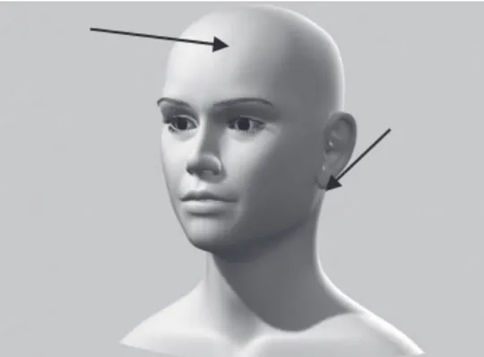 Figure 2. Neck and forehead points to control the skin temperature. 