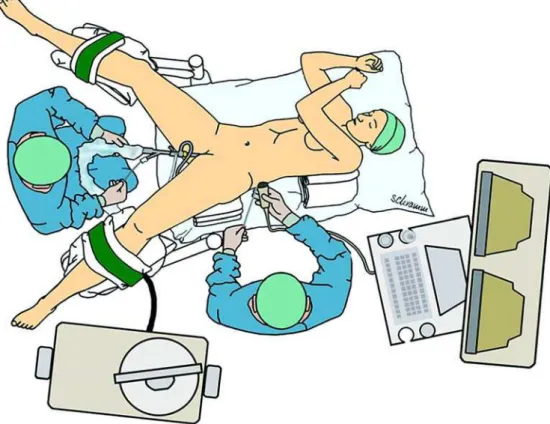 Figure 1 – Patient position on the table with both transurethral and percutaneous access.