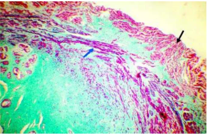 Figure 2 – Fetus with 20 WPC. Section through the prostate base.