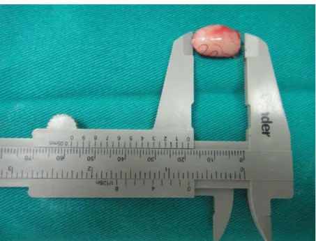 Figura 7.  Paquímetro utilizado para aferição das medidas dos testículos. 