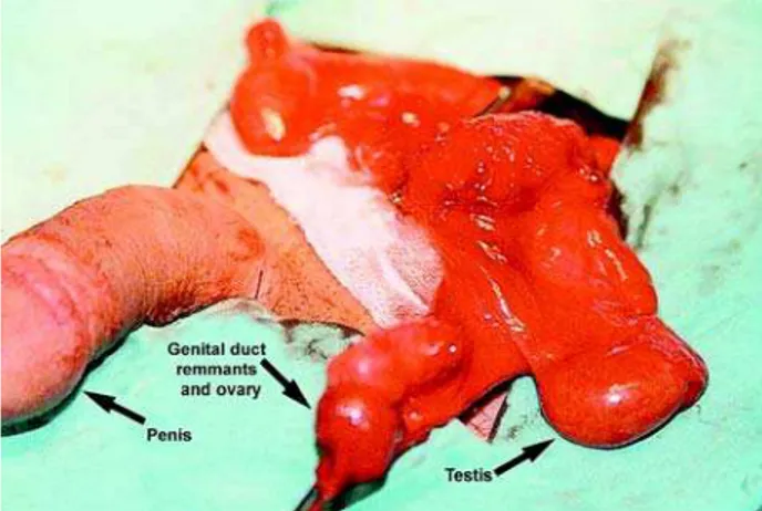 Figure 1 – Intraoperative view of the female genital duct remnants, ovary and testis.
