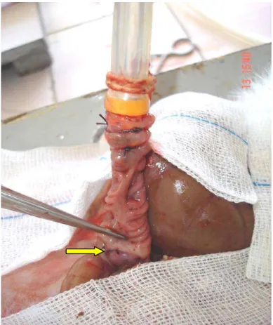 Figura 7 - Conexão entre o segmento proximal à  anastomose (seta) e o sistema tubular para  mensuração da pressão de ruptura