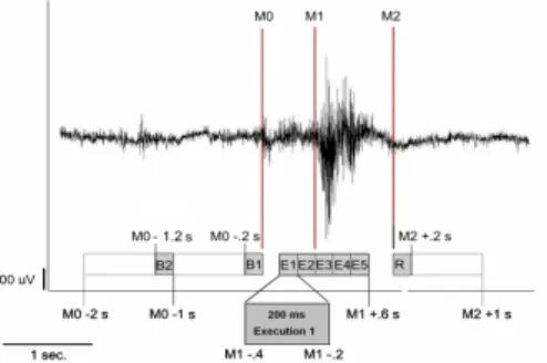 Figure 2.3: EEG record[21] Figure 2.4: EOG record[31]