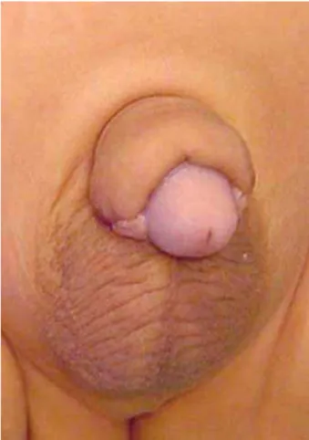Figure 8 – A) and B) Postoperative surgical aspect.