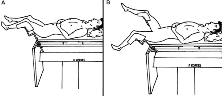 Figure 1 – Patient position during left ureteroscopy: A) Dorsal lithotomy position. B) Dorsal lithotomy with extended leg.