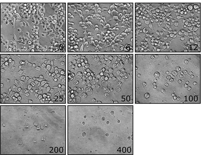 Figure 2 – Photomicrography of the MB49 bladder tumor cell culture exposed to variable concentration of curcumin, showing progres- progres-sive apoptosis
