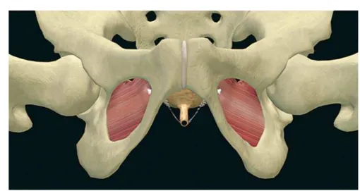 Figure 2 – The needle kit .