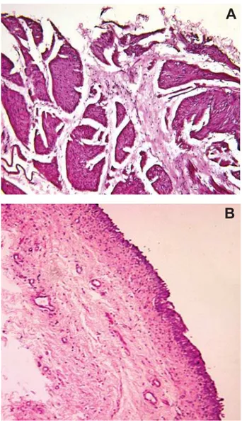 Figure 2 – H &amp; E staining of surgically separated tissue of  detrusor (Panel A) and urothelium (Panel B)