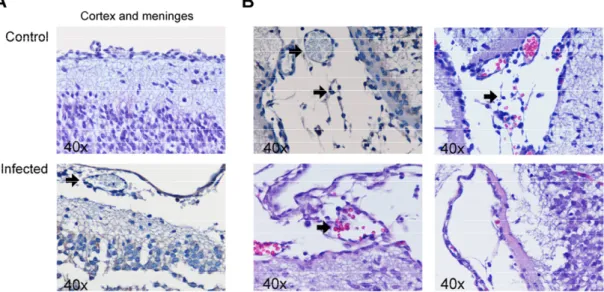 Figure  9  |  Murine  model  of  neonatal  GBS-induced  meningitis.  Histopathology  of  brain  tissues  of  representative  individual  pups  infected  with  GBS  compared  with  non-infected  control,  after  staining  with  H&amp;E