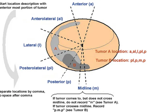 Figure 1 – Guidelines to record tumor location description.