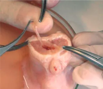 Figure 3 – Cavernous artery.