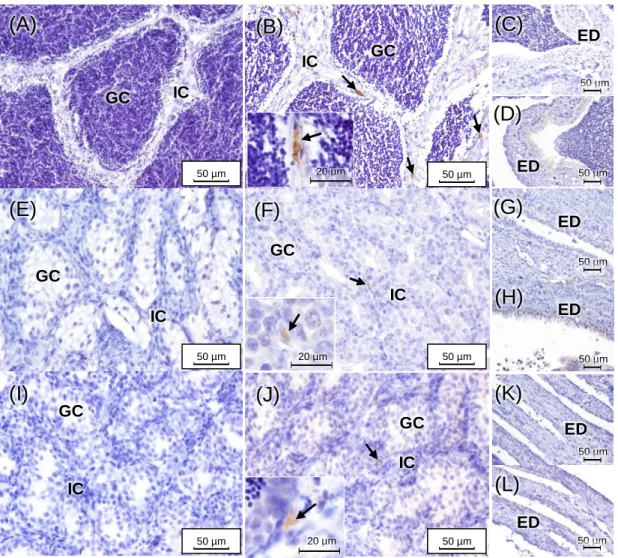 Fig. 11 – CYP17-I immunoreactivity in adult brown trout testes in December (A–D), March (E–H) and  July (I–L)