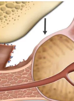 Figure 1 – Clamping and cutting of dorsal vein complex. Figure 2 – Clamping and cutting of dorsal vein complex
