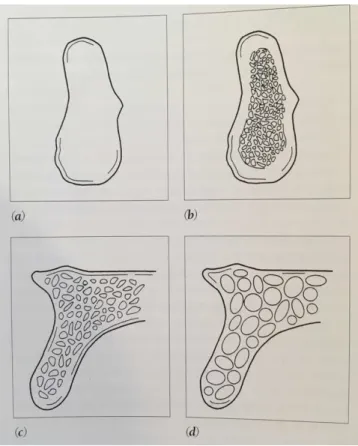 Figura 16 Descrição macroscópica das 4 densidades ósseas de Misch (a) D1; (b) D2; (c) D3; (d) D4