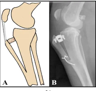 Figure  5:  Two  techniques  for  advancement  of  the  tibial  tuberosity.  (A)  Illustration  of  Maquet’s technique for TTA
