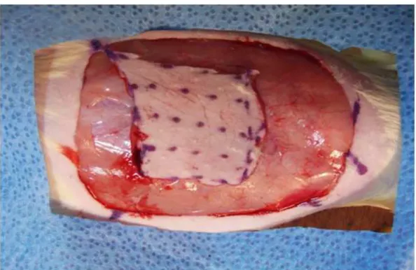 FIGURA 2 – Incisões da pele e da tela subcutânea 