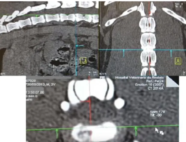Figura 5. Imagens de tomografia computorizada do  segmento lombar de cadela com herniação do disco 