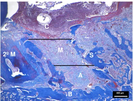 Figura  3:  Divisão  anatômica  do  alvéolo  em  terços  apical,  médio  e  cervical.  A:  terço  apical;  M:  terço  médio;  C:  terço  cervical;  2°M:  segundo  molar  superior;  B:  osso basal; S: septo ósseo