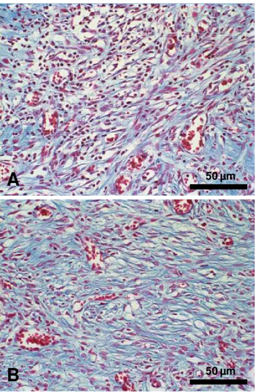 Figura 8: Análise histológica dos alvéolos 7 dias após as exodontias. Observa-se,  no terço apical, maior quantidade de núcleos celulares nos (A) alvéolos controle  quando  comparados  com  os  (B)  alvéolos  tratados  com  NTC-HY  100 g/mL,  sugerindo cic