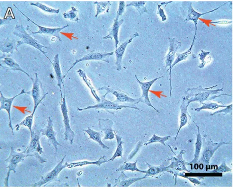 Figura  3:  Microscopia  óptica  de  contraste  de  fase  de  cultura  de  osteoblastos  primários  extraídos a partir de calvárias de ratos neonatos