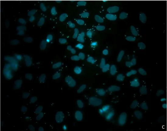 Figura  8.  Imagem  representativa  de  astrócitos  infectados  com  cepa  Y  de  T.  cruzi  nas  seguintes  proporções de parasitos/célula: A (2:1); B (5:1); C (10:1)