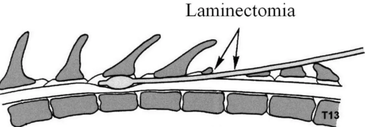 Figura 1. Ilustração demonstrando o método de realização de trauma por compressão com balão  (Adaptado de Vanickí et al., 2001)