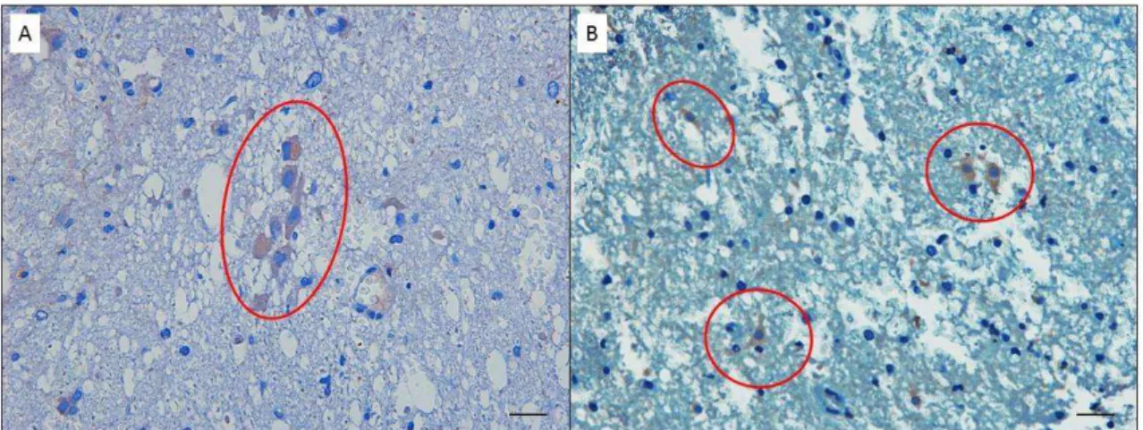 Figura 8. Fotomiscroscopias de cortes histológicos de medulas espinhais de ratos submetidos a  trauma  e  tratados  com  CTM