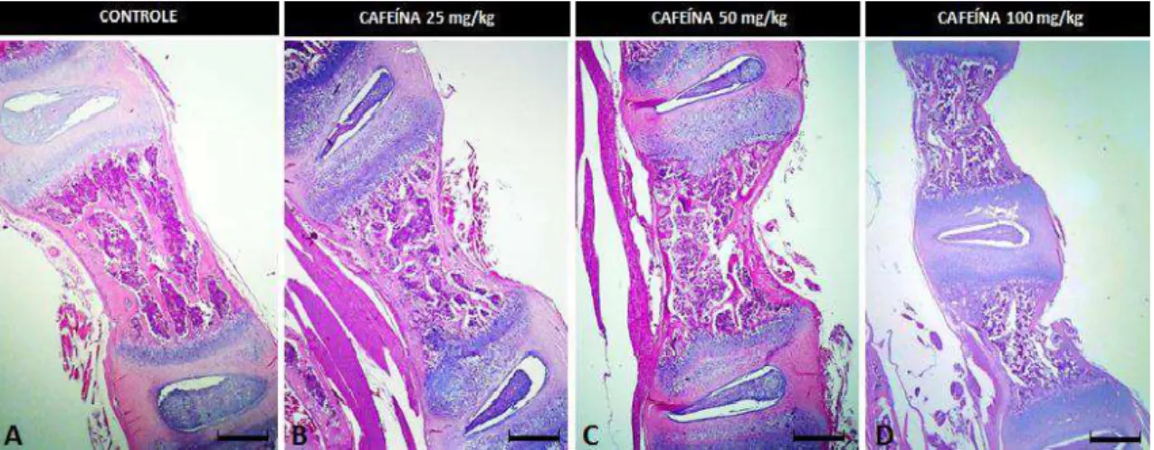 Figura 5. Vértebras lombares de ratos com 21 dias de idade. HE, Bar = 236,51  μm. A, B, C e D) Grupos controle e  tratados  com  25,  50  e  100  mg/Kg  de  cafeína,  respectivamente