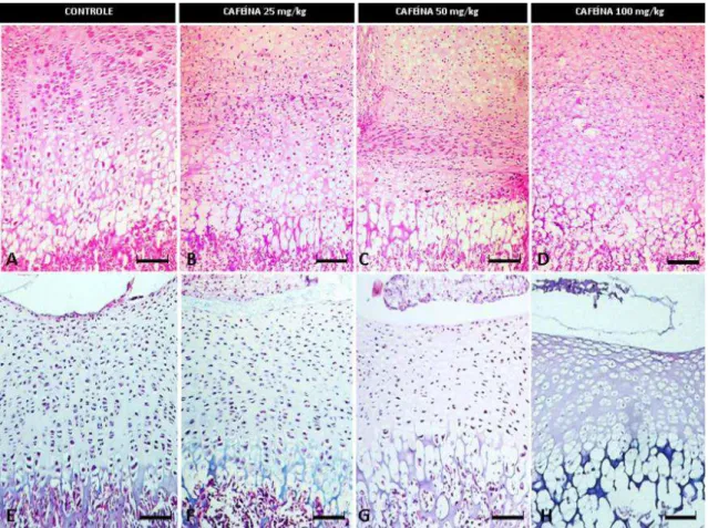 Figura 6. Ratos com três dias de idade. HE, Bar = 47,29 μm. A, B, C e D) Placa epifisária da tíbia dos grupos controle 