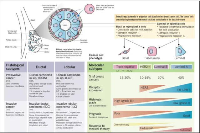 Figure 4 - BrCa pathogenesis and histologic versus molecular subtypes, by Eric Wong and Joana  Rebelo