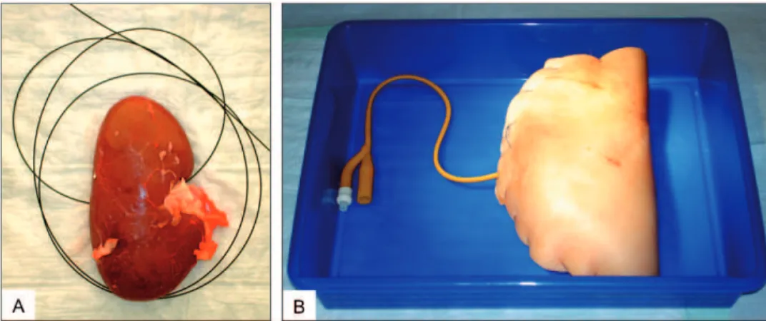 Figure 3 -  Guide-wire for easy access to the renal pelvis (A) and wrapped organ model,  closed by running sutures, in the plastic tray for subsequent training (B).