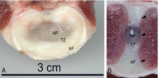 Figura 5 - Cortes transverso (A)  e sagital (B) do disco intervertebral de L5-L6, mostrando do núcleo pulposo (NP),  ânulo fibroso (AF), zona de transição (TZ) e placas cartilagíneas (setas)