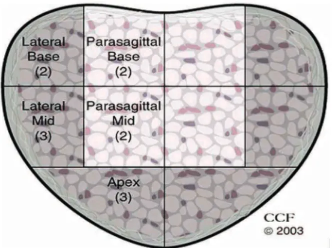 Figure 1 – Template showing location of cores obtained in 24- 24-core needle  transrectal ultrasound biopsy