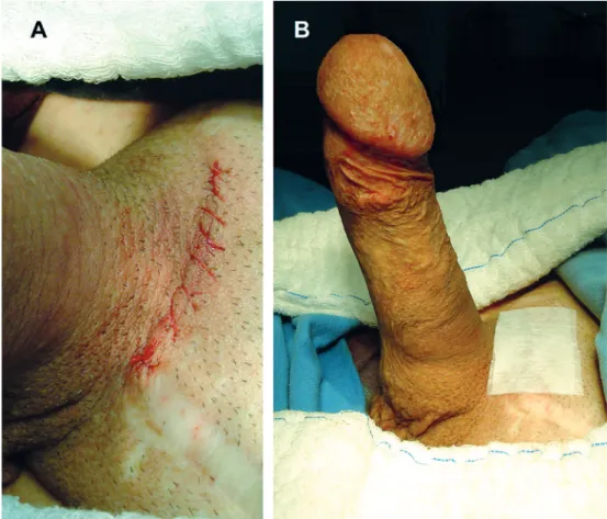 Figure 6 – Final aspect.