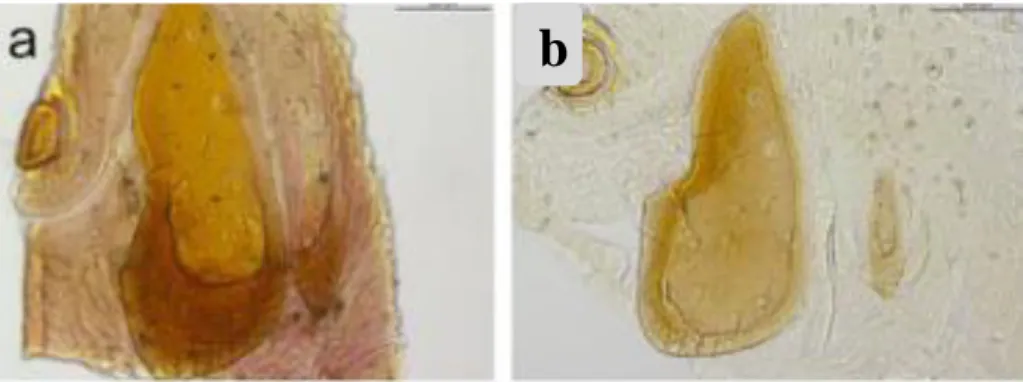 Fig.  5:  Differences  between  males’  adanal  plates  R.  turanicus  (a)  vs  R  sanguineus  (b):  (a)  presents  this  structure in R