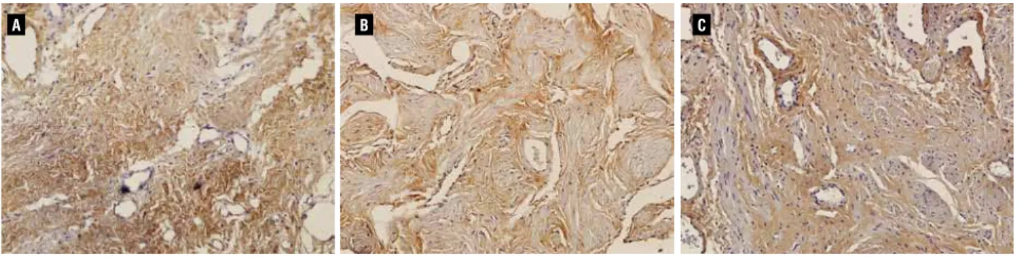 Figure 3 - Imunohistochemical staining for Type III collagen from Control group (A), Proximal edge of stenotic group (B) and  Distal edge of stenotic group (C), showing a similar distribution in all groups (Immunolabelling, X200).