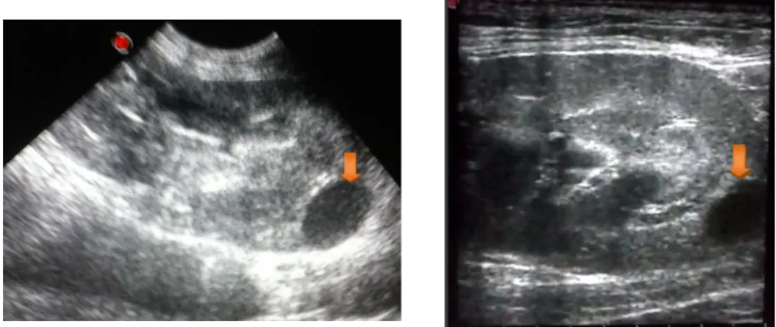 Figura 7 e 8. Ecografia realizada a canídeo com quistos renais (seta laranja). Caso do HVMN
